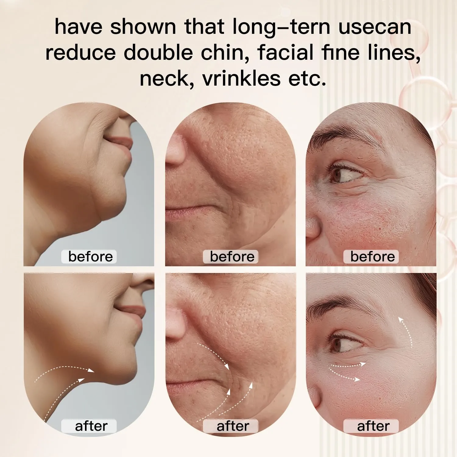 Microcurrent-Facial-Neck Device Face Massage Machine, 3 Modes Skin Care-Heat, Vibration, Facial Device for Skin Care, Improvement, Firming, Tightening and Smoothing